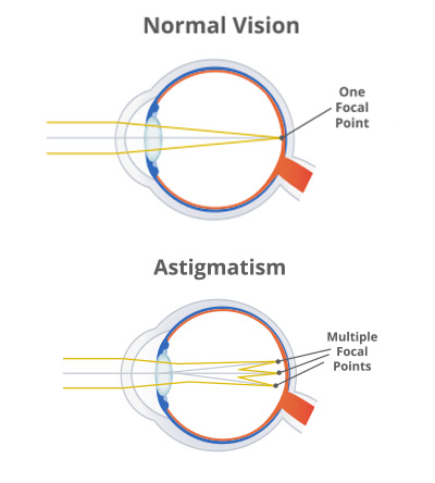 Drs. Shannon Chandler and Lesa Davis | Contact Lenses, Treatment of Ocular Allergies and Macular Degeneration